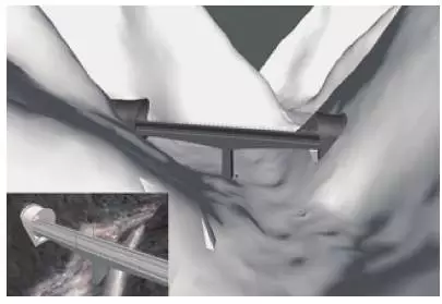 【BIM应用】BIM助力西成客专，天堑变通途 BIM视界 第12张